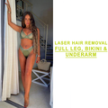 Laser Hair Removal Full Leg, Bikini & Underarm - 6 Treatments