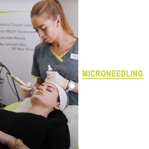 In Clinic Spa Day - Microneedling Course of 3